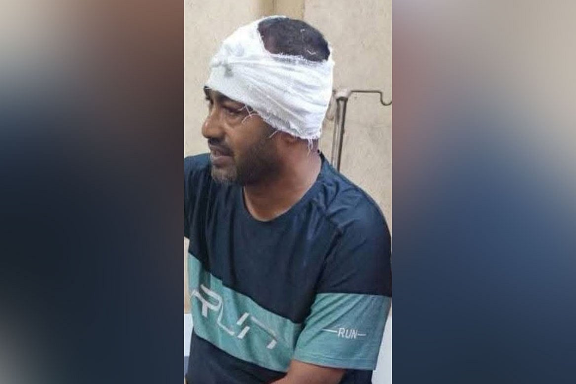 কুষ্টিয়ায় জাসদের সাবেক নেতার ওপর সন্ত্রাসী হামলা, মাথায় ১১ সেলাই